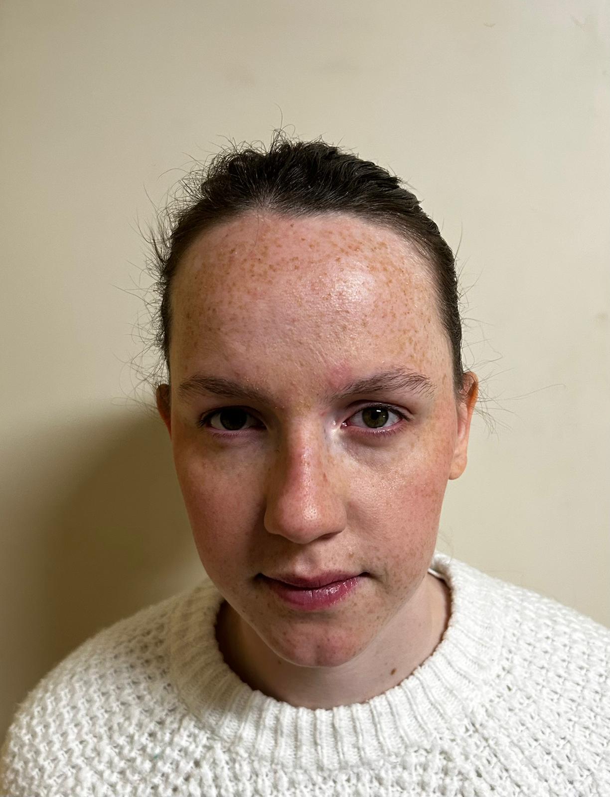 Celine MEICHSNER